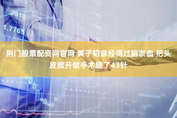 荆门股票配资网官网 黄子韬曾经得过脑淤血 把头皮掀开做手术缝了43针
